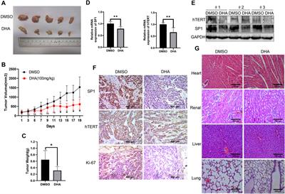 Human Telomerase Reverse Transcriptase as a Therapeutic Target of Dihydroartemisinin for Esophageal Squamous Cancer